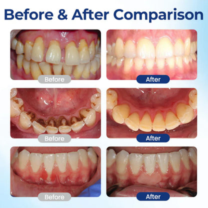 🆙 avafera® Advanced Oral Repair Care — Extra-Strength Bee Venom Drops Against Loose Teeth Bleeding Gums & Plaque — Premium Mouthwash Alternative